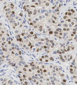 TLE3 Rabbit Polyclonal Antibody