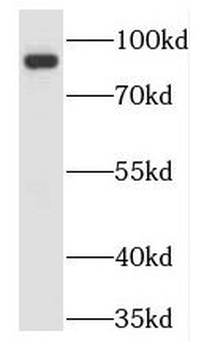 TLE3 Rabbit Polyclonal Antibody