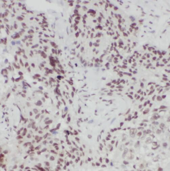 TLE3 Rabbit Polyclonal Antibody