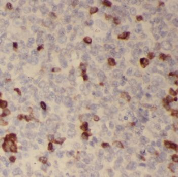 TLR3 Antibody
