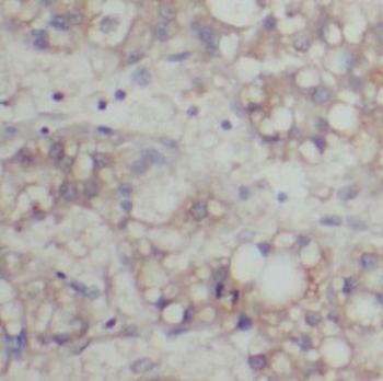 TLR4 Rabbit Polyclonal Antibody