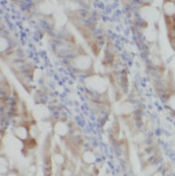 TLR7 Rabbit Polyclonal Antibody