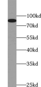 TMC1 Rabbit Polyclonal Antibody