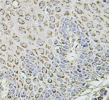 TMC1 Rabbit Polyclonal Antibody