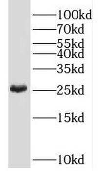 TMED4 Rabbit Polyclonal Antibody