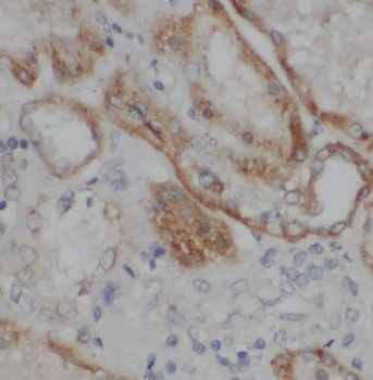 TMEM154 Rabbit Polyclonal Antibody