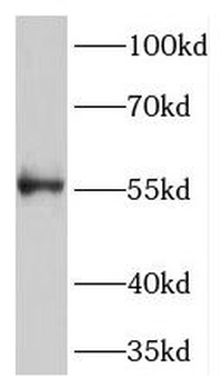 TMEM175 Rabbit Polyclonal Antibody