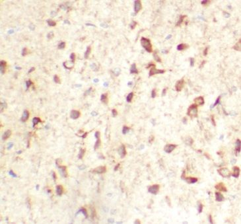 TMEM175 Rabbit Polyclonal Antibody