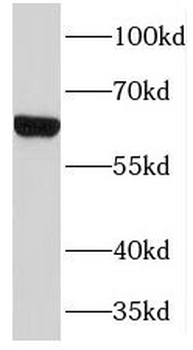 TMEM87A Rabbit Polyclonal Antibody