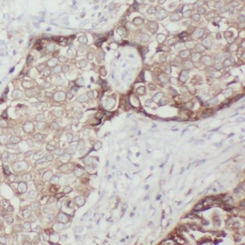 TMEM87A Rabbit Polyclonal Antibody