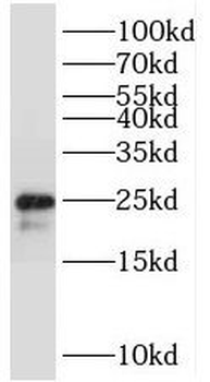 TMEM9B Rabbit Polyclonal Antibody