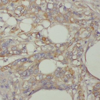 TMEM9B Rabbit Polyclonal Antibody