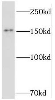 TMF1 Rabbit Polyclonal Antibody