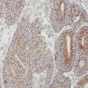TMF1 Rabbit Polyclonal Antibody
