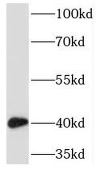 TMOD2 Antibody