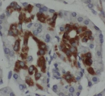 TMPRSS4 Antibody