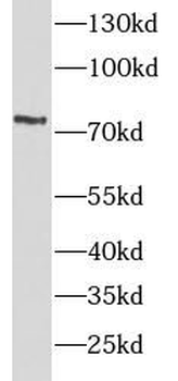 TNFRSF1B Antibody