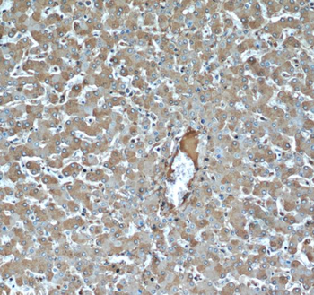 TNIP2 Antibody