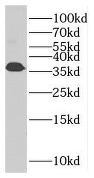 TNNT3 Rabbit Polyclonal Antibody