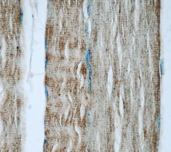 TNNT3 Rabbit Polyclonal Antibody