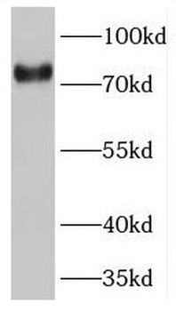 TNS4 Rabbit Polyclonal Antibody