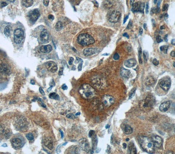 TNS4 Rabbit Polyclonal Antibody