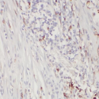 TOE1 Antibody