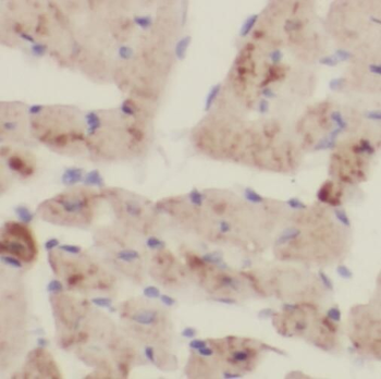 TOMM70 Rabbit Polyclonal Antibody