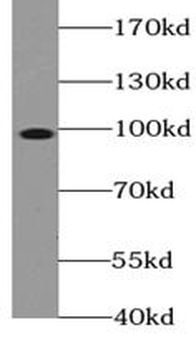 TOP1 Rabbit Polyclonal Antibody