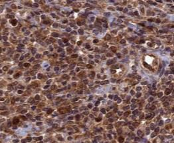 TOP1 Rabbit Polyclonal Antibody