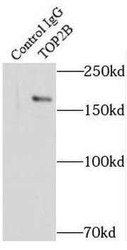 TOP2B Rabbit Polyclonal Antibody