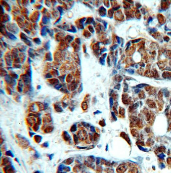TOP2B Rabbit Polyclonal Antibody