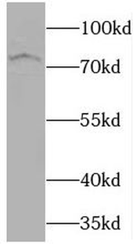 CRTC1 Rabbit Polyclonal Antibody