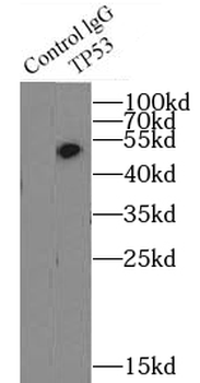 TP53 Rabbit Polyclonal Antibody