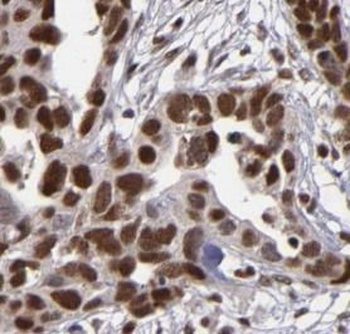 TP53 Rabbit Polyclonal Antibody