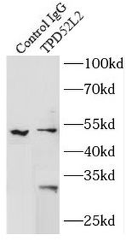TPD52L2 Rabbit Polyclonal Antibody