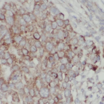 TPD52L2 Rabbit Polyclonal Antibody