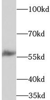 TPH2 Rabbit Polyclonal Antibody