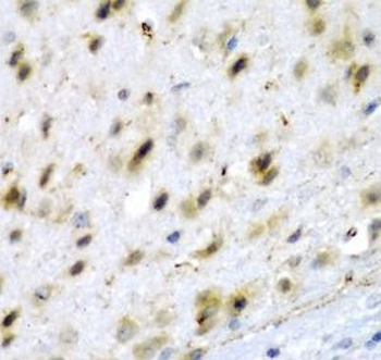 TPH2 Rabbit Polyclonal Antibody