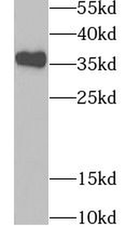 TPM2 Antibody