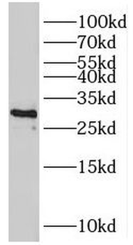 TPM4 Antibody