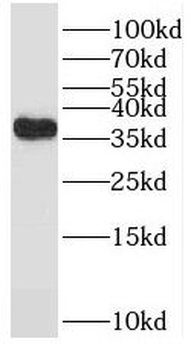 TPRX1 Rabbit Polyclonal Antibody
