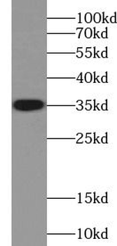 TPSAB1 Rabbit Polyclonal Antibody