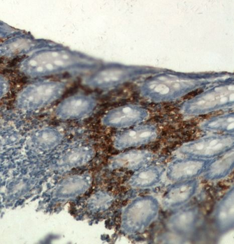 TPSAB1 Rabbit Polyclonal Antibody