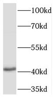 TPST2 Rabbit Polyclonal Antibody