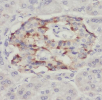 TPST2 Rabbit Polyclonal Antibody