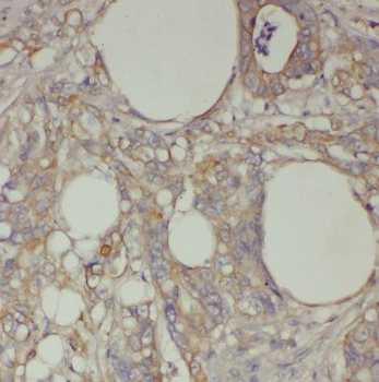TPT1 Rabbit Polyclonal Antibody