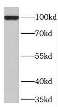 TPX2 Rabbit Polyclonal Antibody