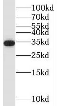 TRA2A Rabbit Polyclonal Antibody