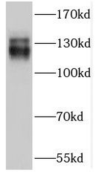 TRAPPC9 Rabbit Polyclonal Antibody